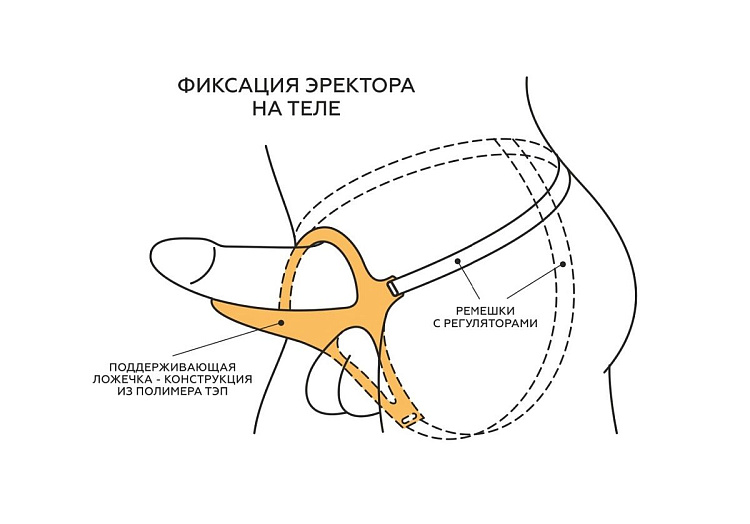 Телесный эректор-ложечка с фиксацией на ремешках MEN STYLE